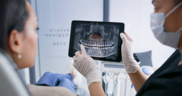 Licensed Dental Implants service in San Angelo, TX - Smile Center Dentistry