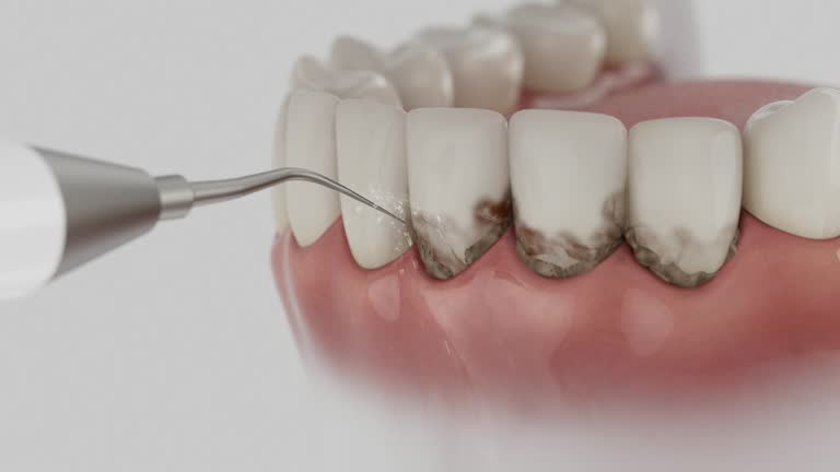 Reliable Dental Implants contractor in San Angelo, TX by Smile Center Dentistry